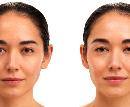 Skin before and after consistent use