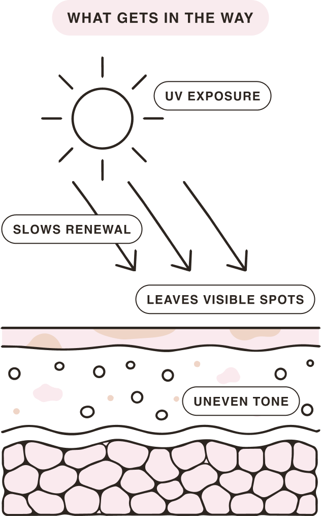 What gets in the way: UV exposure and slowed renewal leave visible spots and uneven tone.